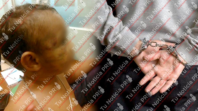 Hombre golpea la cara de un bebe con puños en Naguabo