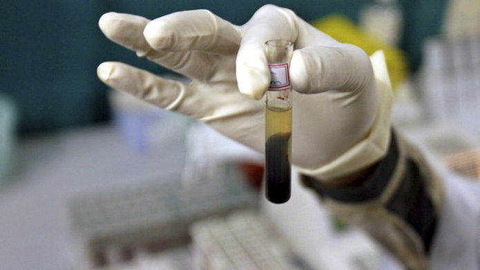 Descubren agentes que neutralizan al VIH