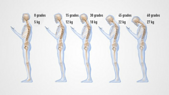 Â¿QuÃ© daÃ±o hace a las cervicales mirar constantemente el mÃ³vil?
