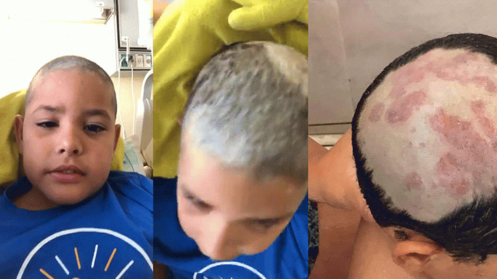  Video: Mujer publica video, explicando como su hijo adquiri&oacute; una bacteria en playas de Gu&aacute;nica y Cabo Rojo 