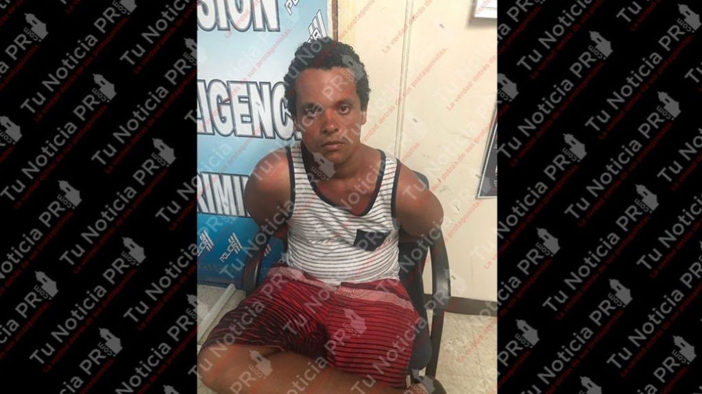  Fiscal&iacute;a eval&uacute;a ir en alzada por cargo tentativa de asesinato caso agresi&oacute;n a anciana 