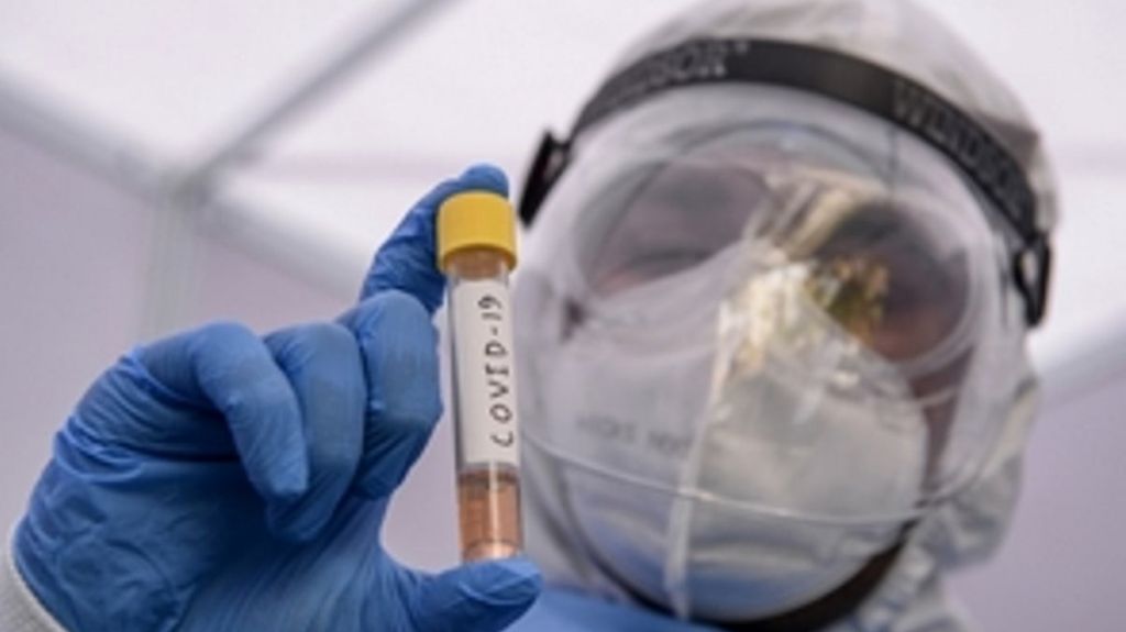  Coronavirus/Gobierno ruso dona al país 4,000 kits de pruebas para tratar el Covid-19 