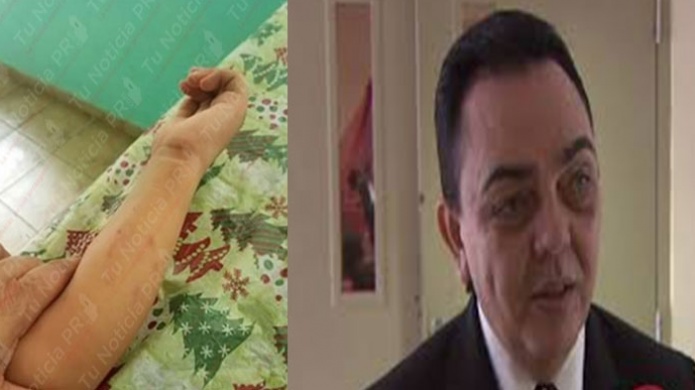 DefensorÃ­a de las Personas con Impedimentos reacciona ante agresiÃ³n de maestra contra niÃ±o de educaciÃ³n especial