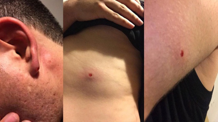 Joven denuncia noche de terror en la placita de Santurce fue atacado con pistolas "Airsoft" 