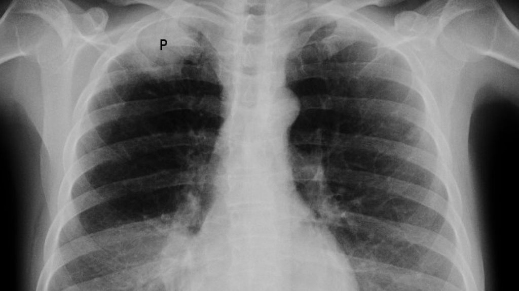  Centro de Im&aacute;genes recibe certificaci&oacute;n del Colegio Americano de Radiolog&iacute;a de Estados Unidos 