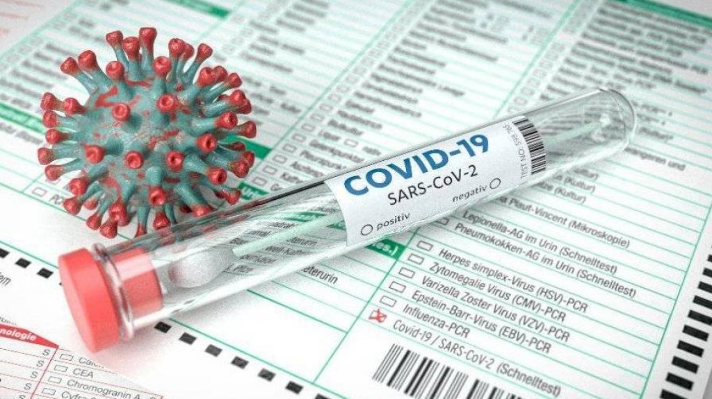  Salud reporta ocho muertes, 206 casos confirmados, 24 probables y 209 casos sospechosos adicionales 