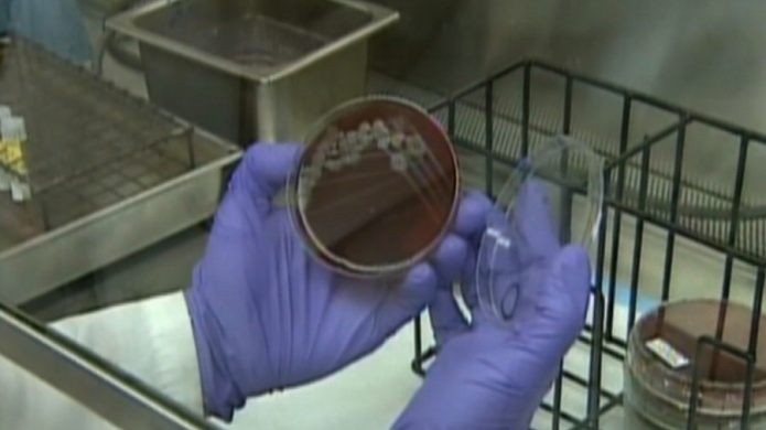 Paquetes de Ã¡ntrax vivo fueron enviados por FedEx