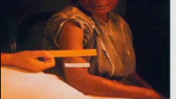 Guatemaltecos demandan a universidad de EE.UU. por contagiarlos con sÃ­filis