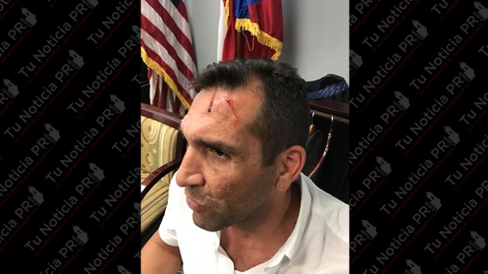 Representante termina con la frente "Rota" luego de encontronazo con manifestante en el capitolio 