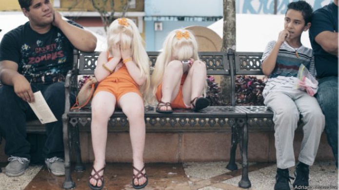 Â¿Por quÃ© hay tantos albinos en Puerto Rico?