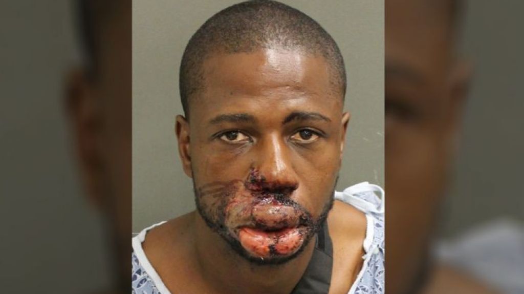  Sospechoso de en un tiroteo en Orlando Florida hospitalizado, se desconocen las razones 