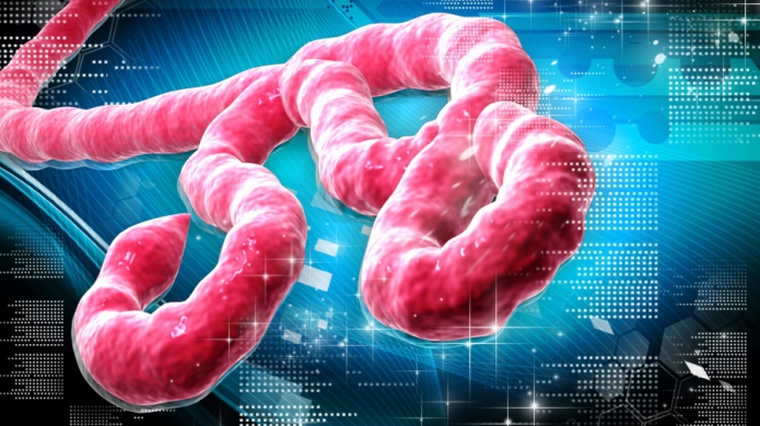 Estados Unidos mandarÃ¡ equipo de expertos para combatir el Ã©bola