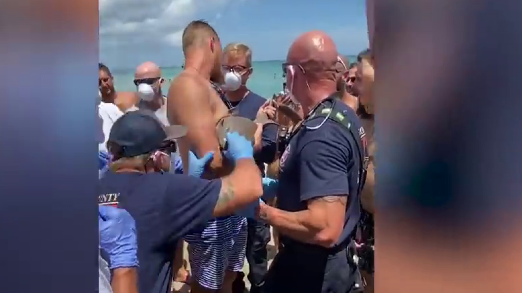  Video: Peque&ntilde;o tibur&oacute;n muerde brazo a hombre y no lo quer&iacute;a soltar 