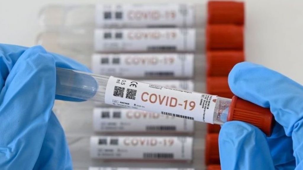  DS reporta 3,324 positivos a COVID-19 y muertes se mantienen en 129 