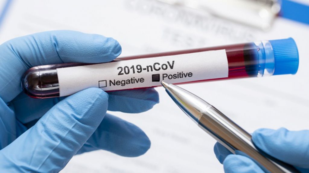  Se reporta una muerte y 182 casos &uacute;nicos positivos adicionales a COVID-19 la isla 