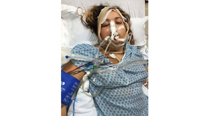 La muerte ronda en un centro de cirugÃ­a estÃ©tica de Hialeah, Florida