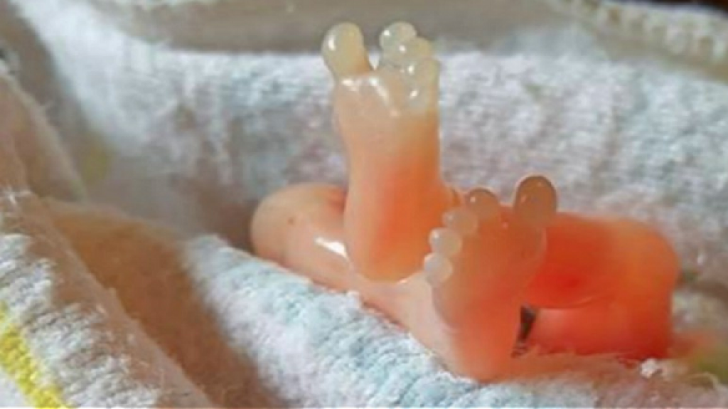  C&aacute;mara aprueba proyecto sobre el aborto 