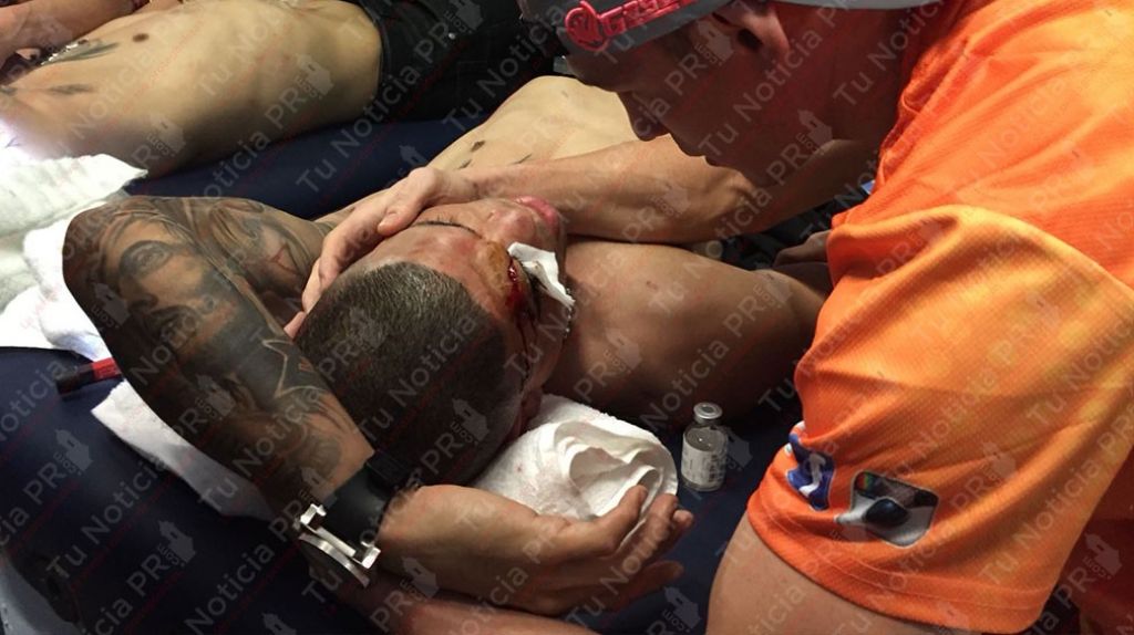  &nbsp; Video: Jayson la &ldquo;Maravilla&rdquo; llega hasta donde Juanma L&oacute;pez, que se encontraba herido luego &uacute;ltimo Round 