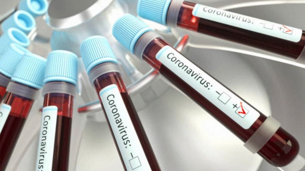  Coronavirus/Especialistas pronostican para mayo una reducción de casos positivos de la pandemia que ha causado 217 muertes y 4,335 infectados 