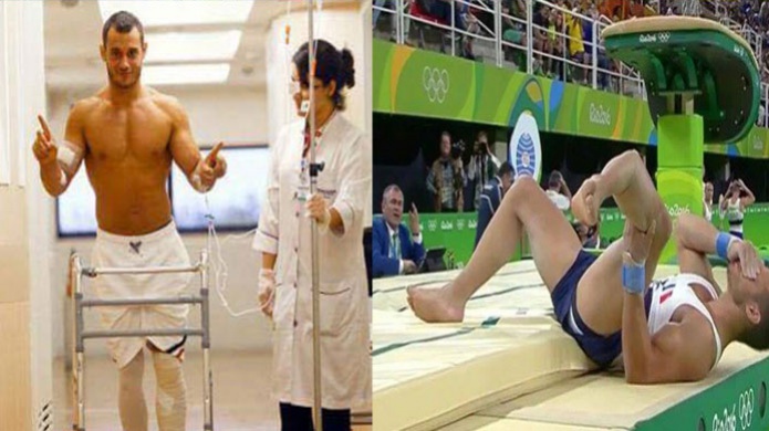 Ya estÃ¡ caminando el gimnasta francÃ©s que sufriÃ³ impresionante fractura 

