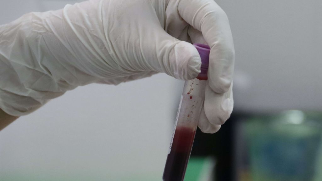  Presentan medida en Puerto Rico para asegurar acceso medicamentos para hepatitis C 