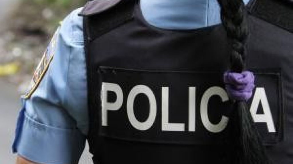  De cuidado ni&ntilde;a mordida por un perro Pitbull en Caguas 