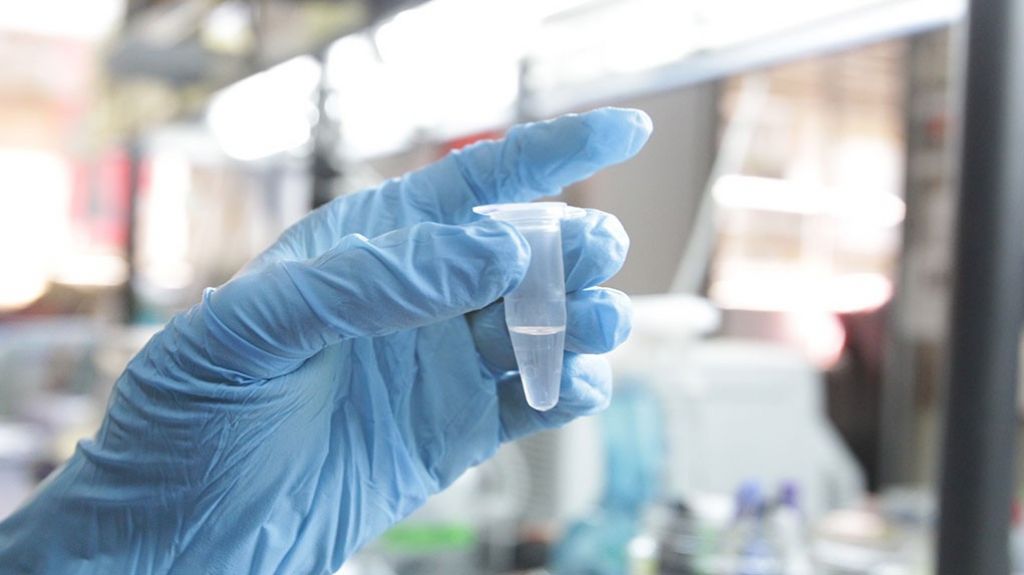  M&eacute;dicos alarmados por aumento c&aacute;ncer cabeza y cuello entre hombres 