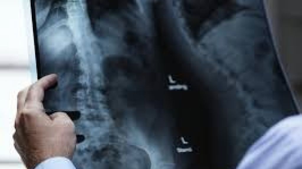  En peligro las operaciones de los centros radiol&oacute;gicos en Puerto Rico 