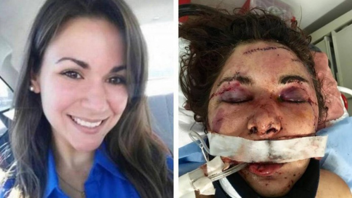 VIDEO: Joven de Miami abre los ojos tras una semana en coma por brutal golpiza