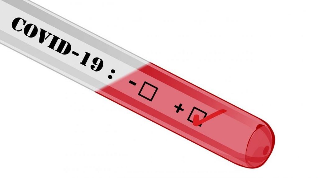  Salud reporta una muerte adicional y 46 nuevos contagiados por Covid-19 