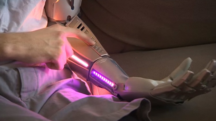 De pelÃ­cula: PerdiÃ³ su brazo y ahora tiene uno biÃ³nico con lÃ¡ser, puerto USB y un dron