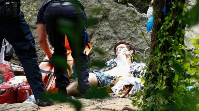 Le amputan la pierna a estudiante de UM herido tras pisar explosivo en Central Park