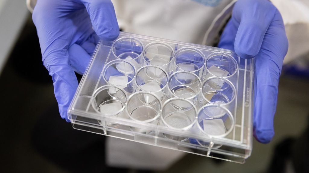  Identifican nueva forma de eliminar c&eacute;lulas cancer&iacute;genas 