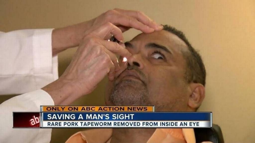  Este paciente veía un punto negro. En el ojo tenía un intruso que le iba a devorar el cerebro 