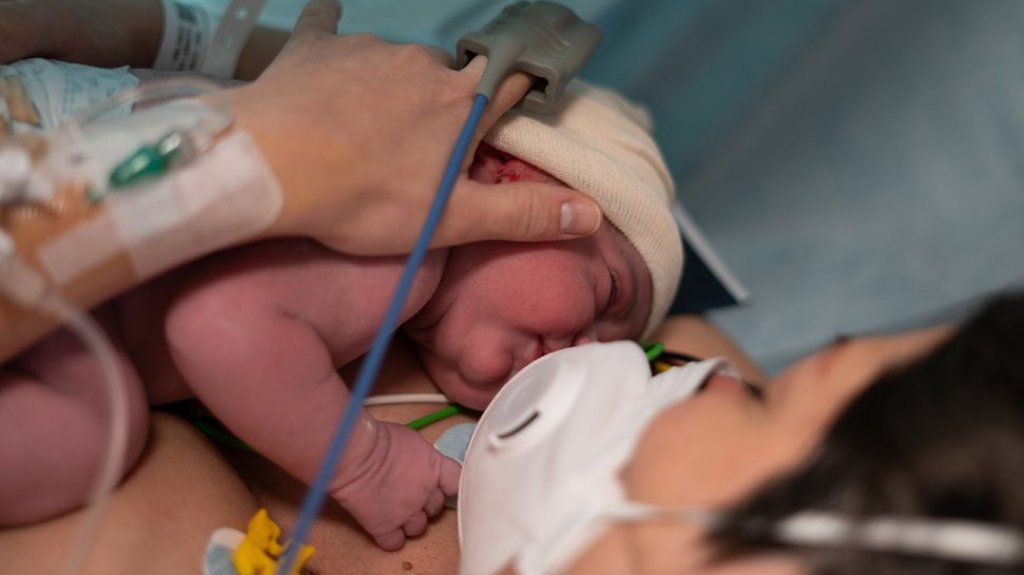  Beb&eacute; en Singapur de madre infectada de Covid-19 nace con anticuerpos, sin ser portador de la enfermedad 