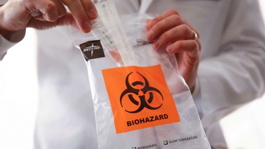  Empresa activ&oacute; protocolo de seguridad ante posibles positivos en tres empleados al Covid-19 