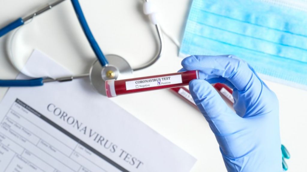  Casi 60 por ciento de casos positivos informados no se ofrece municipio de procedencia 