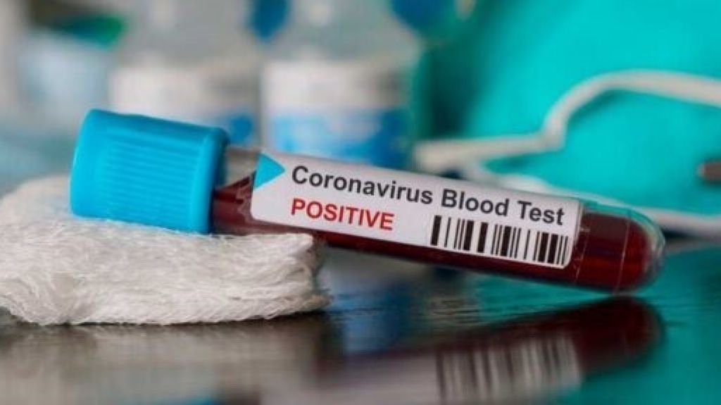  Muere en el estado de Washington el primer paciente por coronavirus en EE.UU. 