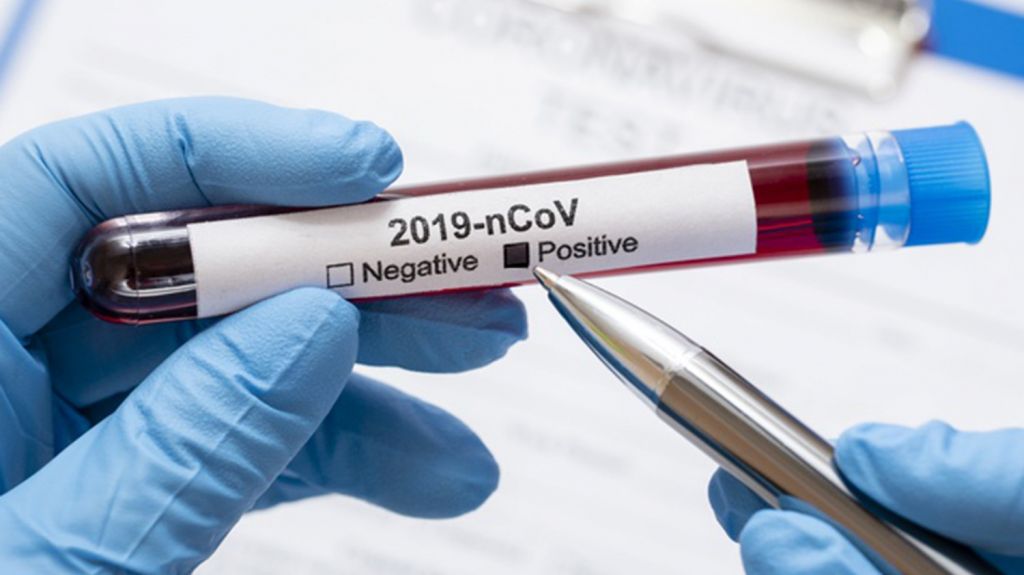  Sistema de Vigilancia del DS no reporta muertes adicionales por COVID-19 en la isla 