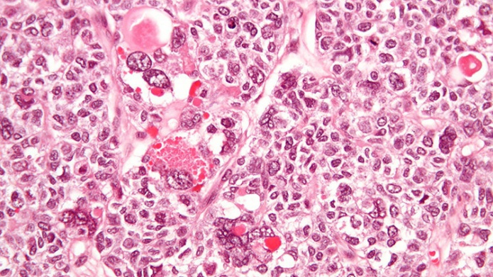 CientÃ­ficos chilenos desarrollan una innovadora terapia contra el cÃ¡ncer