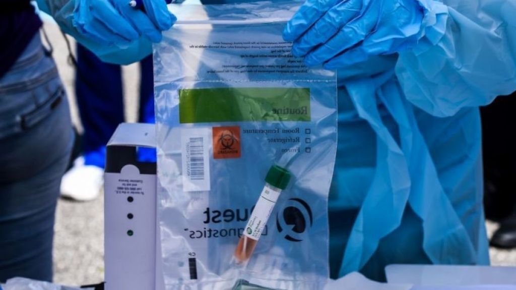  FDA autoriza 19 pruebas para detectar coronavirus 