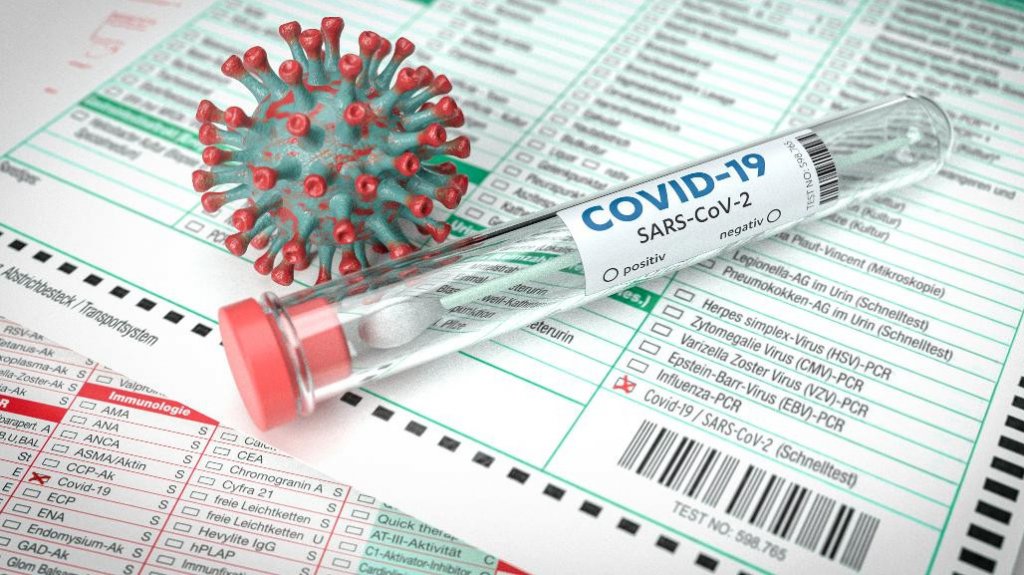  Salud reporta una muerte, 73 personas hospitalizadas y 134 nuevos casos 