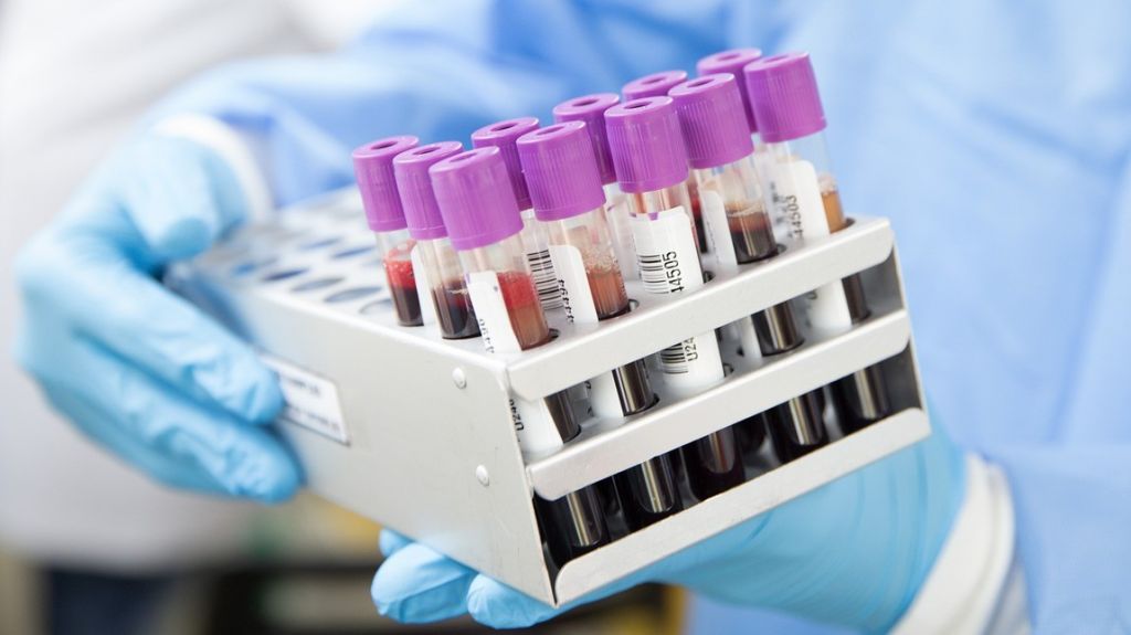  Reportan 3 nuevas muertes por COVID-19 en PR, ahora son 11 