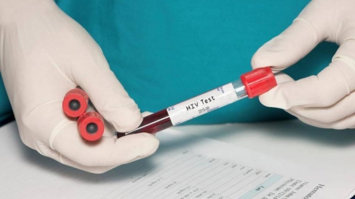 Sur de la Florida lidera nuevos casos de VIH en EE.UU.