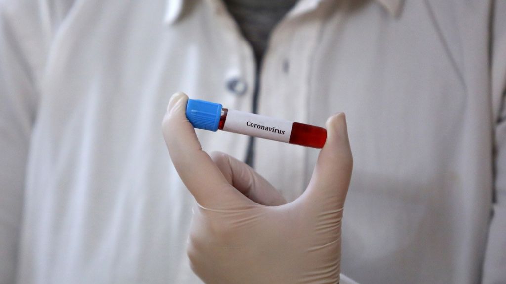  EE.UU. aprueba el uso de un tratamiento contra la malaria en pacientes con coronavirus 