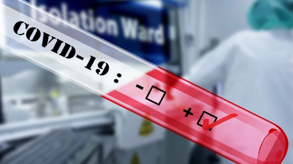  No ha concluido plazo para determinar si se asigna un FEI en caso de compras fallidas de pruebas COVID-19 seg&uacute;n presidenta del OPFEI 