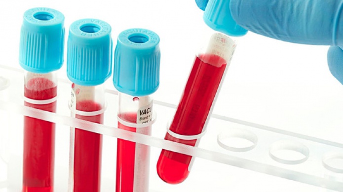 Google quiere que tu smartwatch sea capaz de hacerte anÃ¡lisis de sangre (sin aguja)