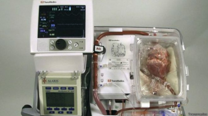 Reino Unido: realizan primer trasplante en Europa con corazÃ³n que no late