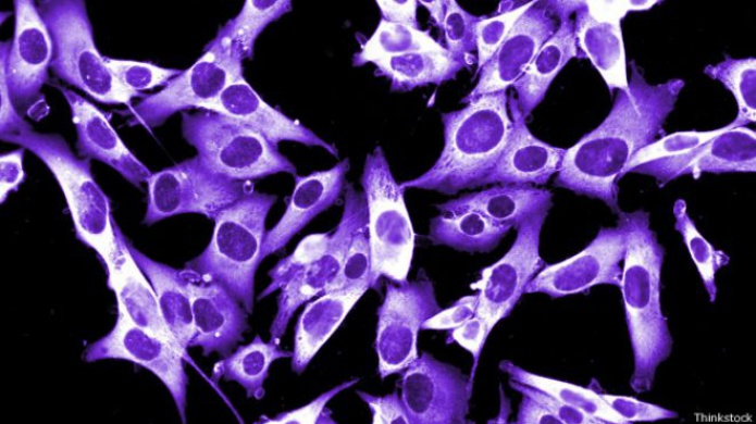 La inmunoterapia contra el cÃ¡ncer de piel que tiene un Ã©xito nunca antes visto