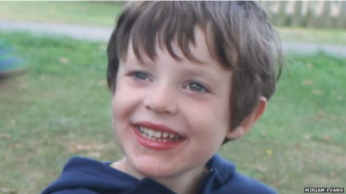 El niÃ±o que sufre la rara enfermedad del "cerebro mareado"